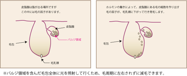 脱毛機バジル領域