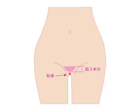 VIO VIO