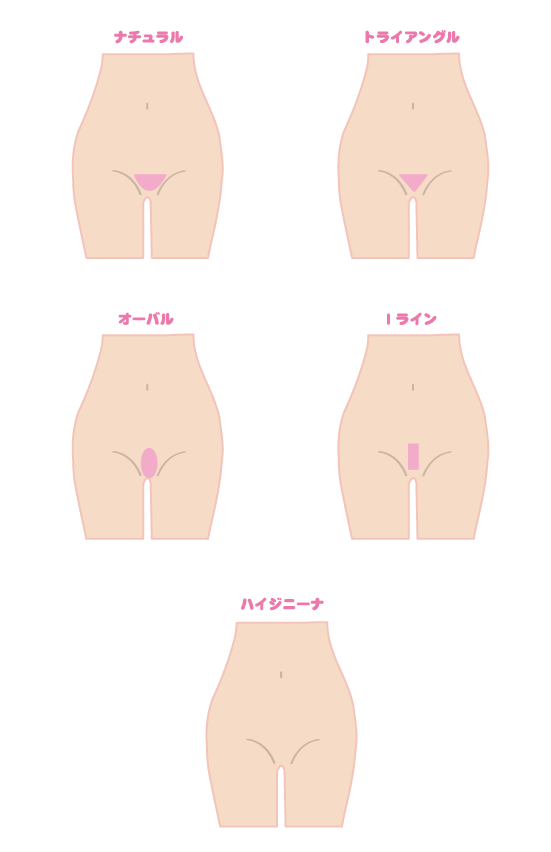 Vゾーンデザイン