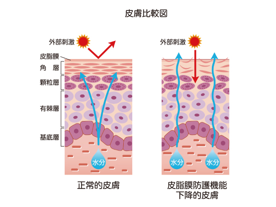 花粉症対策